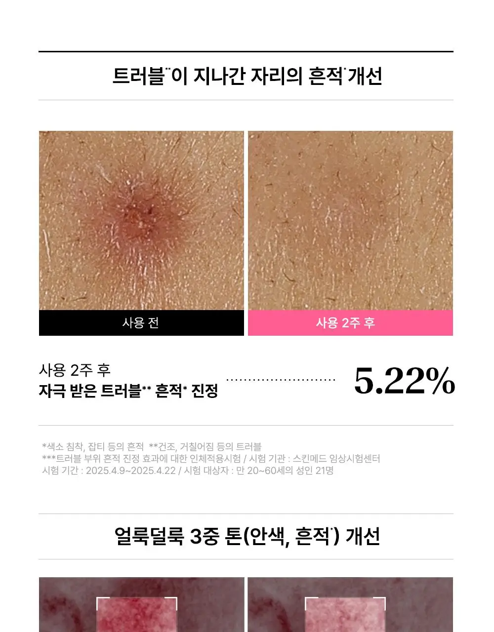 [한정기획/본품+리필+크림미니어처] 비긴스 바이 정샘물 흔적 세럼 상세페이지 31